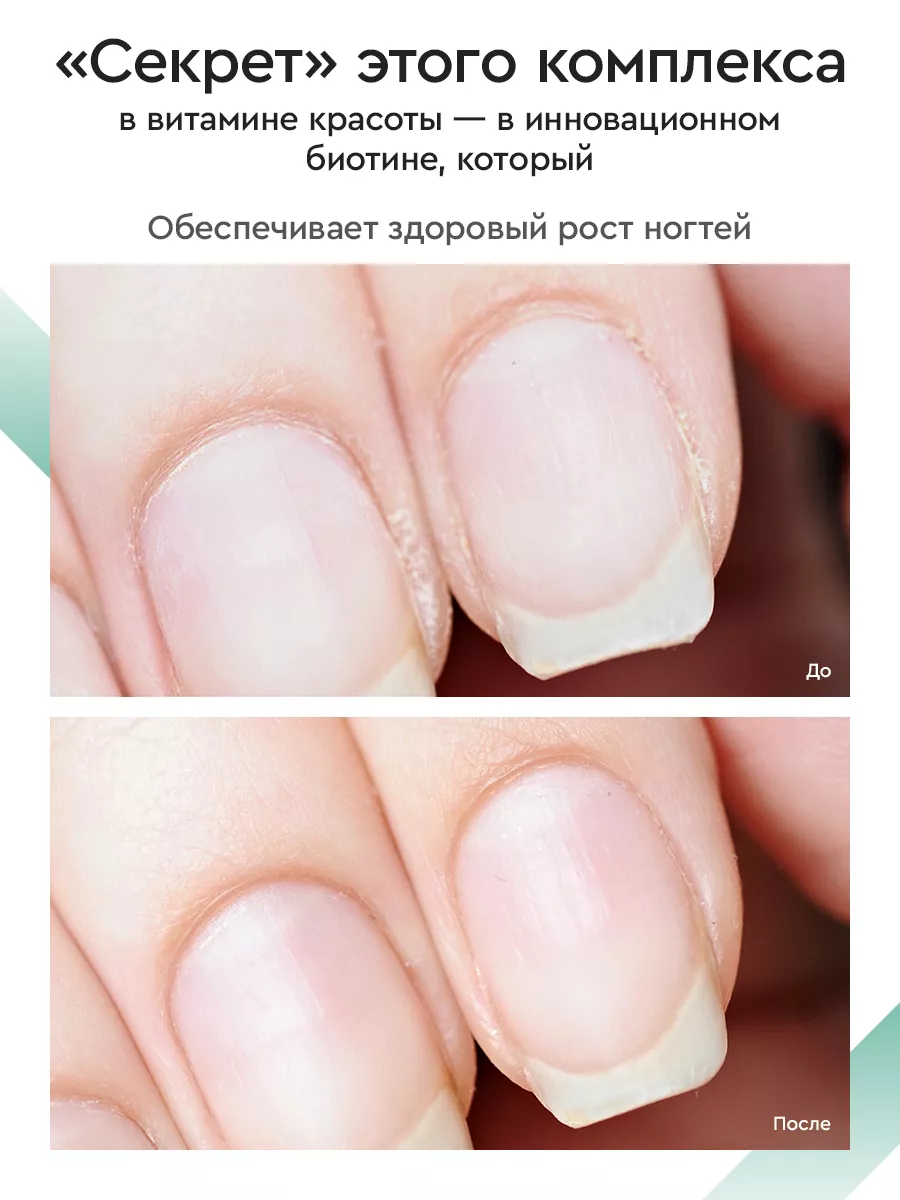 Витамины для волос, кожи и ногтей SKIN, NAILS & HAIR SmartLife 100014312  купить за 1 199 ₽ в интернет-магазине Wildberries