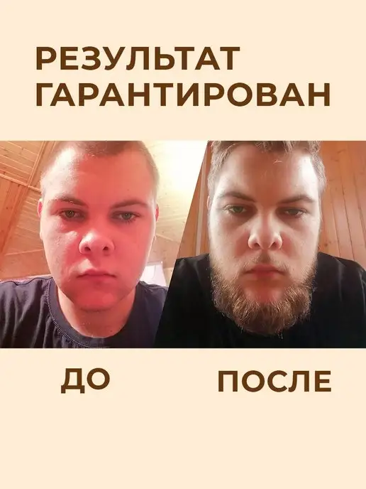 Beardman Набор Gold для роста бороды 5в1, золотой, фото 4
