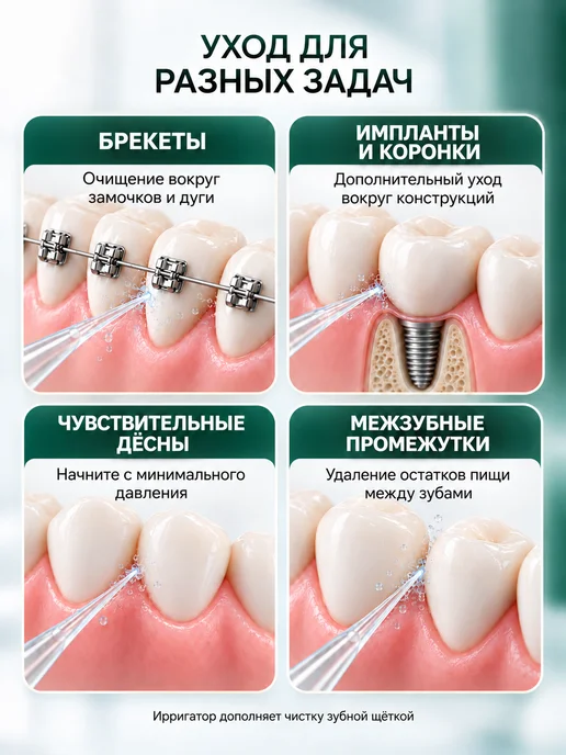DOHEALTH Ирригатор для зубов портативный со щеткой, черный, фото 6