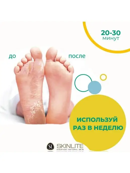 SKINLITE Маска-носки для ног Абрикос, вариант, фото 2