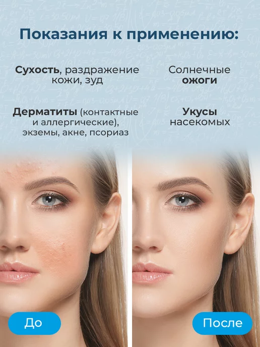 redox Термальная вода с гиалуроновой кислотой cпрей для лица, вариант, фото 2