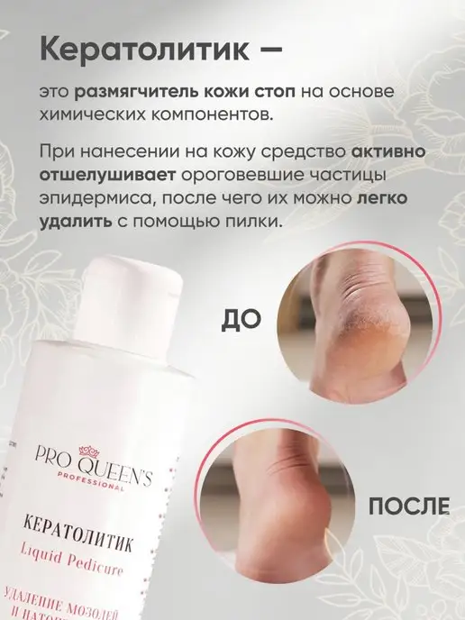 Pro Queens Средство для пяток, кератолитик, уход за ногами, 200 мл, фото 2