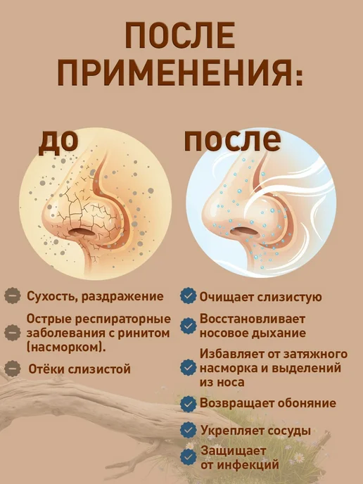 АЛТЫН СОЛОК Спрей с маточным молочком и прополисом от заложенности носа, вариант, фото 6