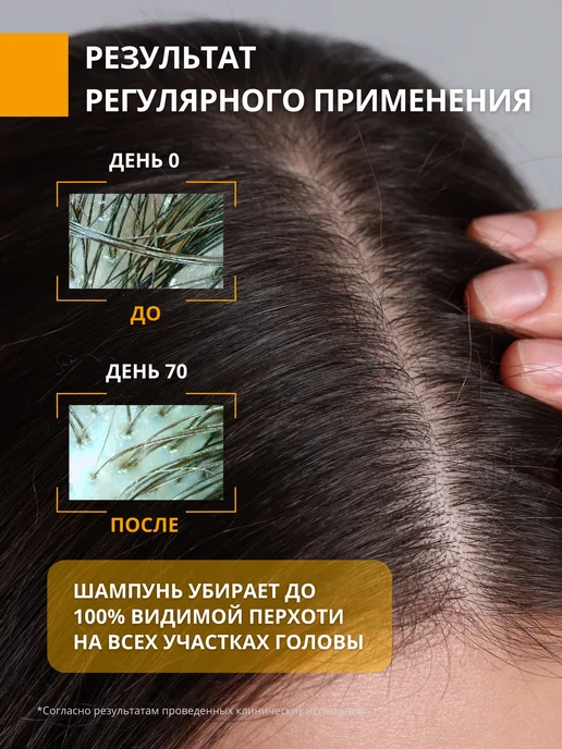DR. MARCUS HEILER Шампунь от перхоти глубокоочищающий, 250 мл, фото 2