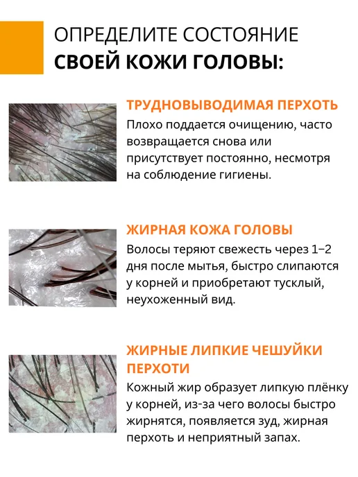 DR. MARCUS HEILER Шампунь от перхоти глубокоочищающий, 250 мл, фото 7