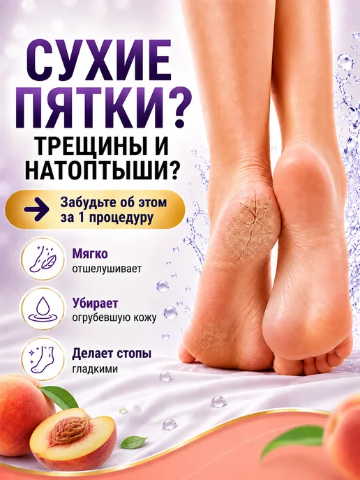 HODAF Пилинг носочки от трещин на пятках, гладкие стопы 2 пары, оранжевый, фото 2