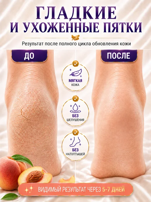 HODAF Пилинг носочки от трещин на пятках, гладкие стопы 2 пары, оранжевый, фото 3