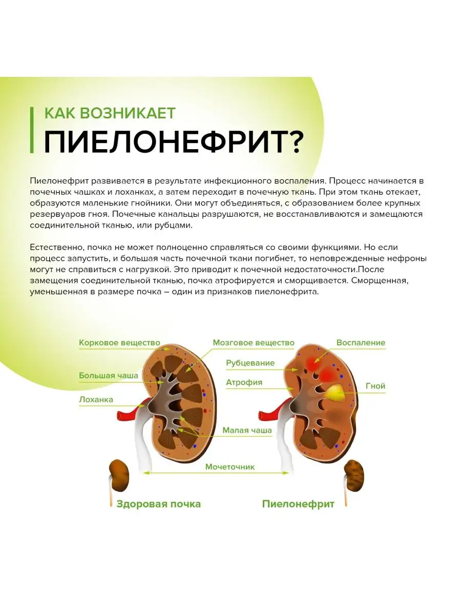 НЕФРОБАК при пиелонефрите, 60 капсул, 400 мг SH PHARMA 94911973 купить за 1  176 ₽ в интернет-магазине Wildberries