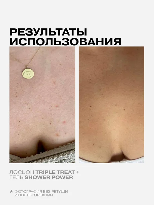 Openface Отшелушивающий тоник лосьон Triple Treat, 150 мл, фото 6