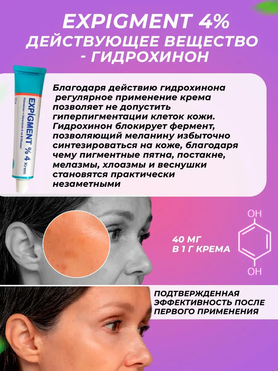 Осветляющий крем при нарушении пигментации кожи Expigment 4% (30 грамм)