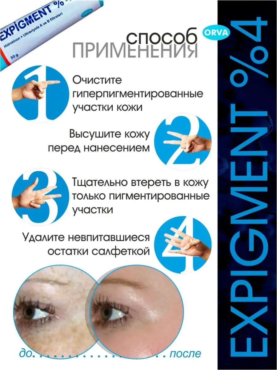 Expigment Мазь от пигментных пятен ORVA 96027708 купить в интернет-магазине  Wildberries