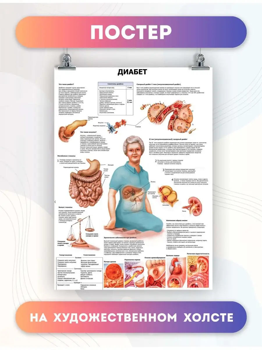 Постер диабет болезни медицина (20) 40х60 см PosterNak 96968554 купить за  899 ₽ в интернет-магазине Wildberries
