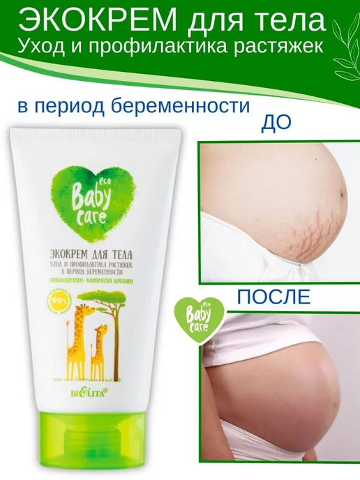 Белита Крем от растяжек для беременных, вариант, фото 2