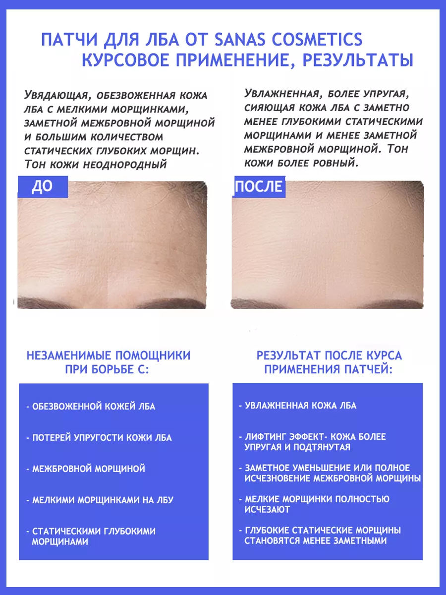 Гидрогелевые патчи для лба от морщин (1 уп. 5 штук) SANAS cosmetics  99552160 купить за 323 ₽ в интернет-магазине Wildberries