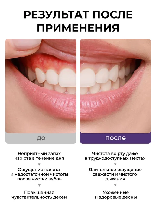 Stomatol Ополаскиватель для рта для чувствительных зубов 500 мл, 500 мл, фото 4