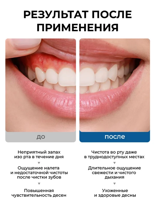 Stomatol Ополаскиватель для рта против кариеса 500 мл, 500 мл, фото 4